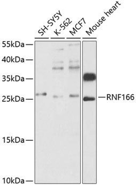 Anti-RNF166 Antibody (CAB12607)