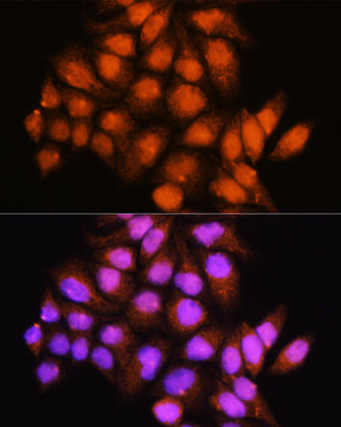 Anti-ADK Antibody (CAB15024)