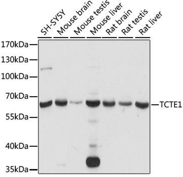 Anti-TCTE1 Antibody (CAB15216)