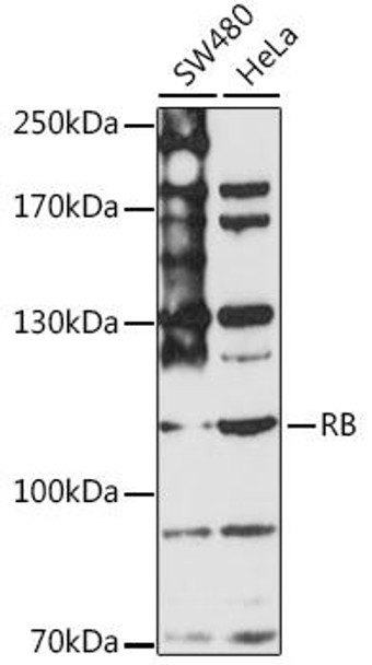 Anti-RB Antibody (CAB16966)