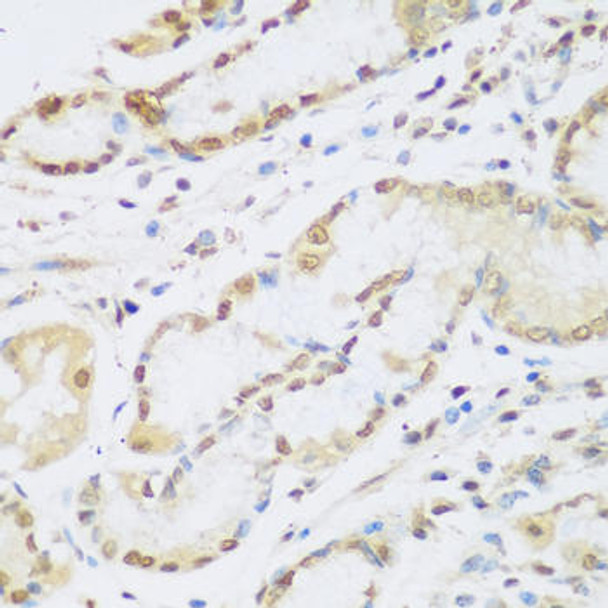 Anti-Cyclin D2 Antibody (CAB1773)