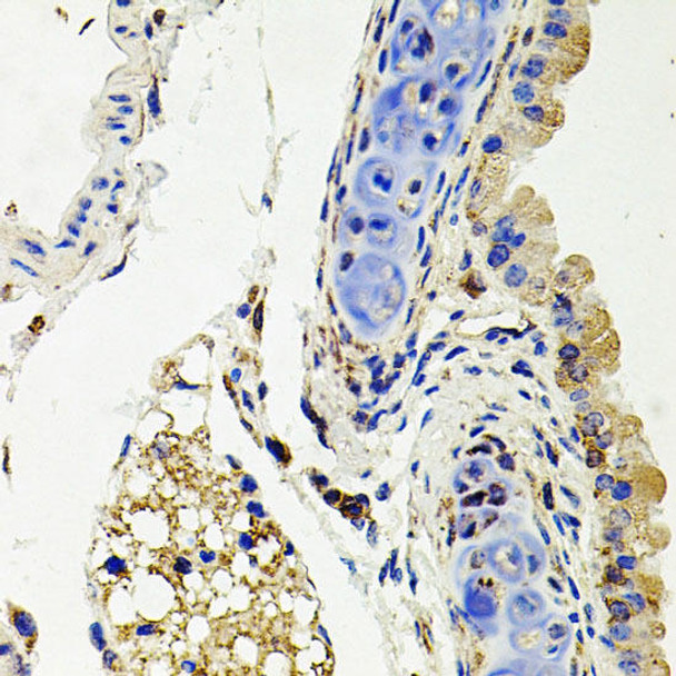 Anti-SDC2 Antibody (CAB1810)