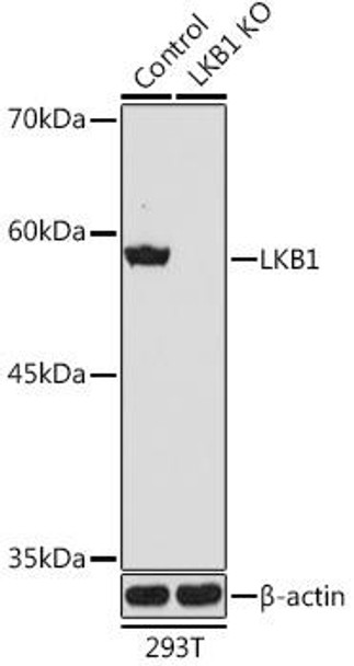 Anti-LKB1 Antibody (CAB2122)[KO Validated]