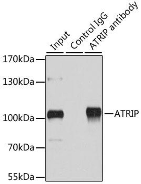 Anti-ATRIP Antibody (CAB5041)