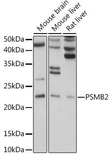 Anti-PSMB2 Antibody (CAB5483)