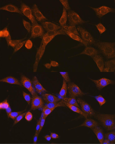 Anti-MAVS Antibody (CAB5764)