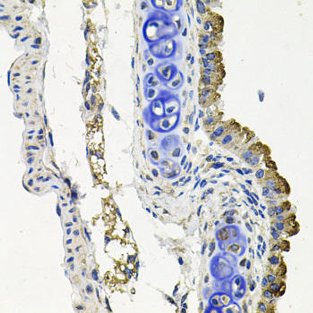 Anti-MARK1 Antibody (CAB8435)