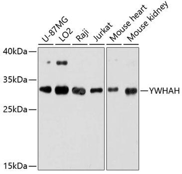 Anti-YWHAH Antibody (CAB9079)