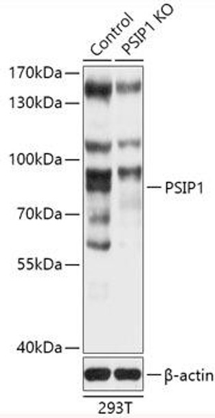 Anti-PSIP1 Antibody (CAB18037)[KO Validated]