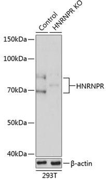 Anti-HNRNPR Antibody (CAB19999)[KO Validated]