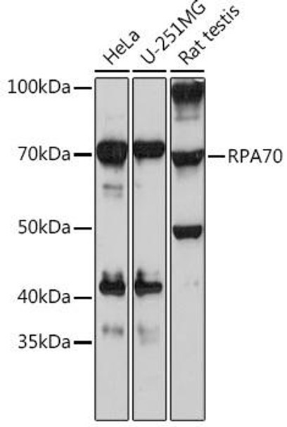 Anti-RPA70 Antibody (CAB3367)