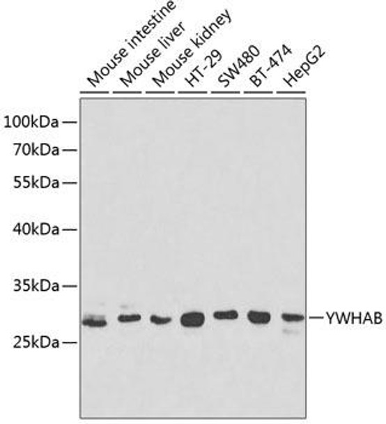 Anti-YWHAB Antibody (CAB1023)