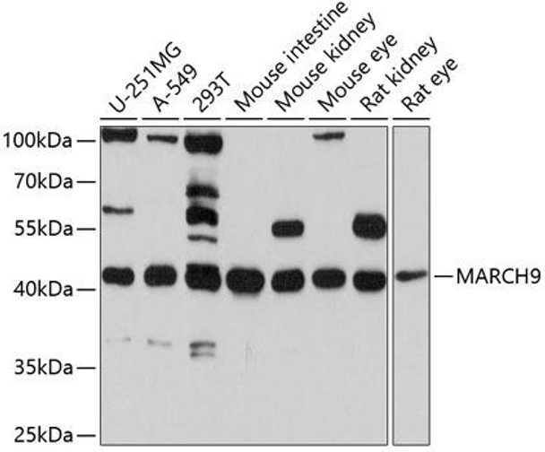 Anti-MARCH9 Antibody (CAB10596)