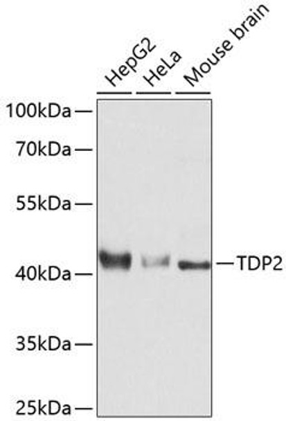 Anti-TDP2 Antibody (CAB11617)