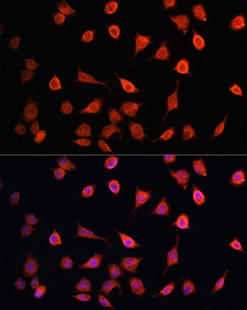 Anti-MRPS27 Antibody (CAB11667)