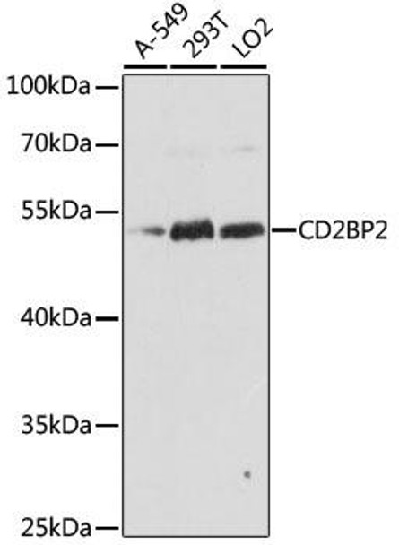 Anti-CD2BP2 Antibody (CAB15777)