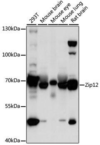 Anti-Zip12 Antibody (CAB16006)