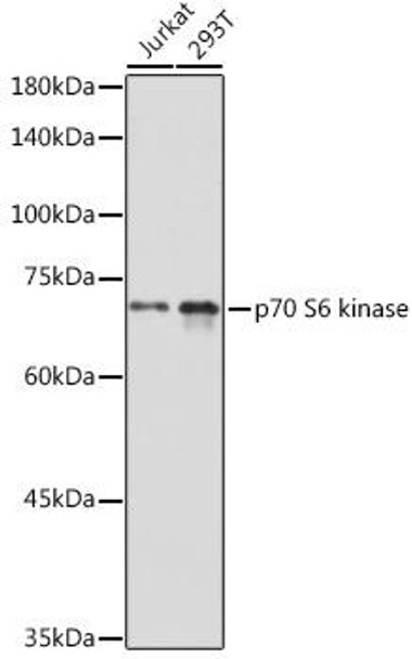 Anti-p70 S6 kinase Antibody (CAB16968)