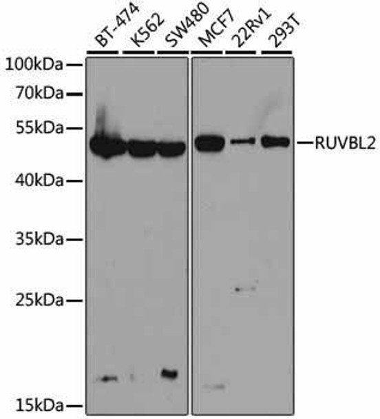 Anti-RUVBL2 Antibody (CAB1905)