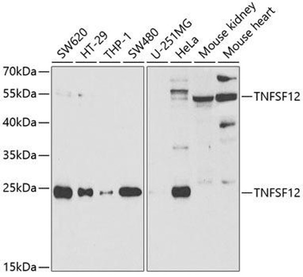 Anti-TNFSF12 Antibody (CAB5659)
