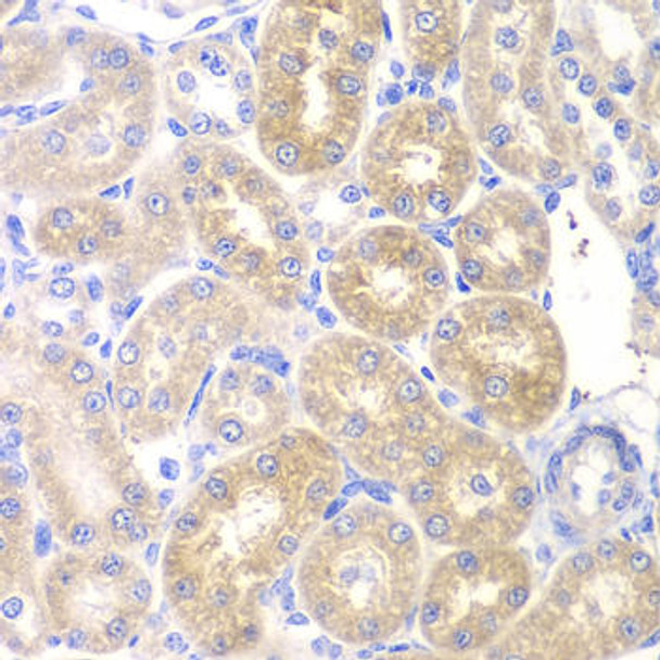 Anti-PNLIP Antibody (CAB6396)