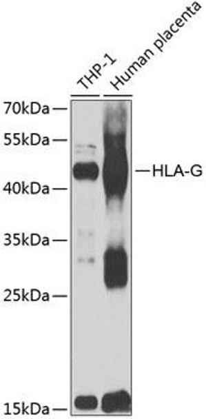 Anti-HLA-G Antibody (CAB7557)