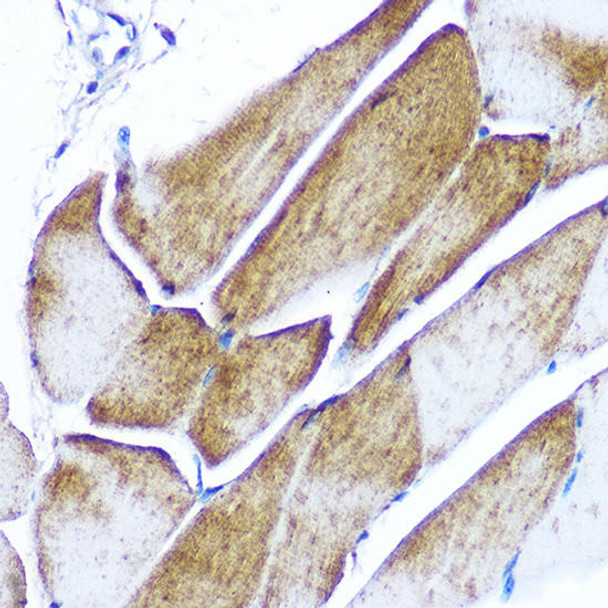 Anti-GLUT4 Antibody (CAB7637)