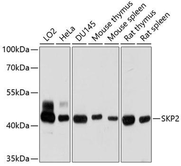 Anti-SKP2 Antibody (CAB7728)