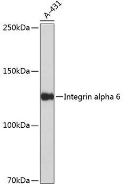 Anti-Integrin alpha 6 Antibody (CAB19070)