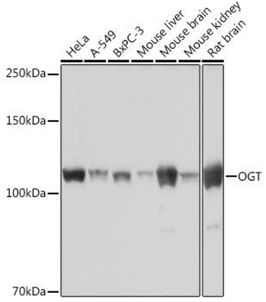 Anti-OGT Antibody (CAB3501)