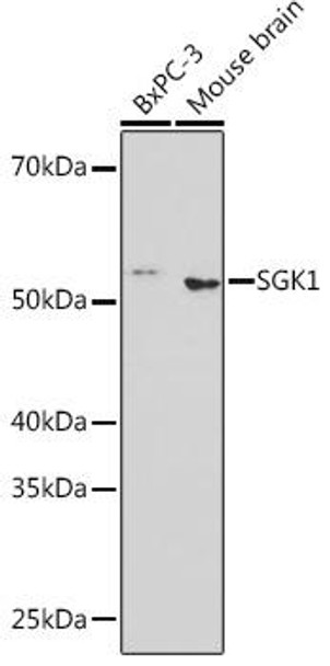 Anti-SGK1 Antibody (CAB3936)