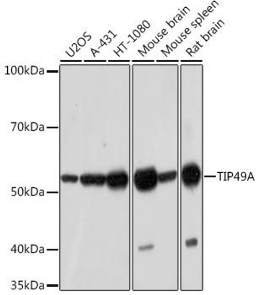 Anti-TIP49A Antibody (CAB5180)