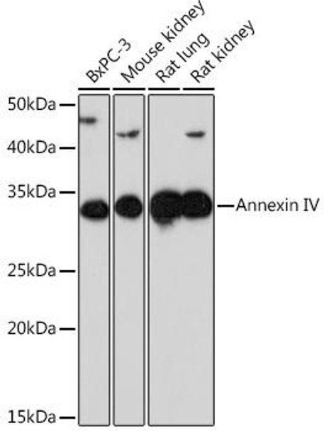 Anti-Annexin IV Antibody (CAB9203)