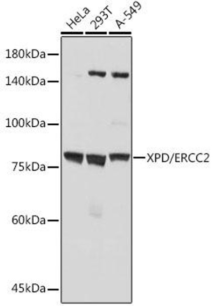 Anti-XPD/ERCC2 Antibody (CAB19241)