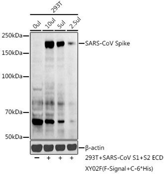Anti-SARS-CoV Spike Antibody (CAB20605)