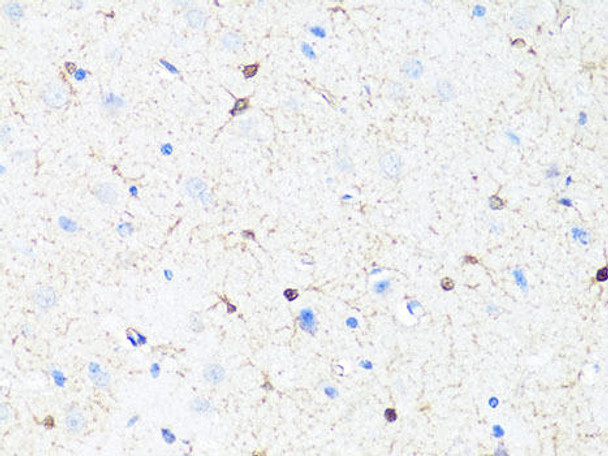 Anti-TH Antibody (CAB0028)