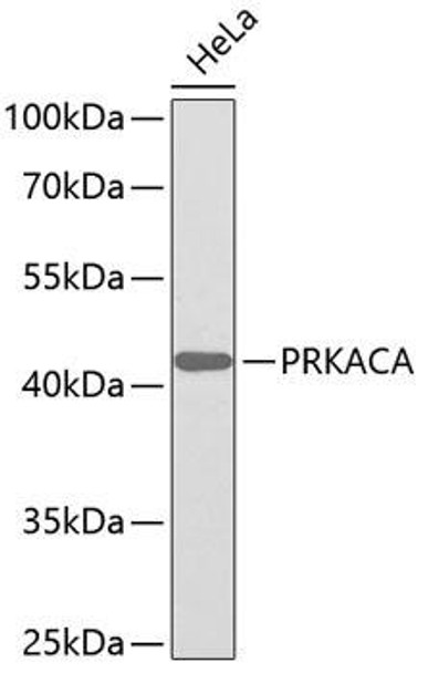 Anti-PRKACA Antibody (CAB0798)