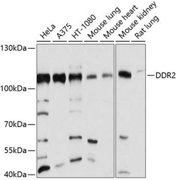 Anti-DDR2 Antibody (CAB10060)