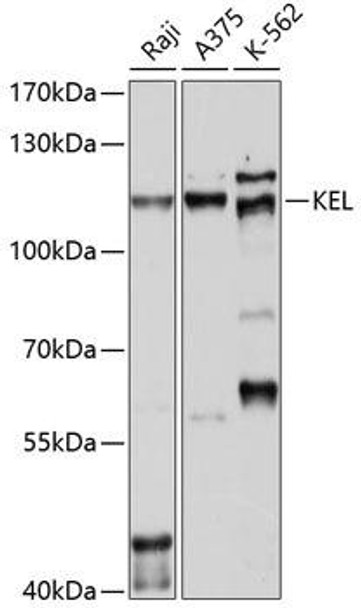 Anti-KEL Antibody (CAB10116)