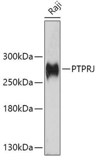 Anti-PTPRJ Antibody (CAB10169)
