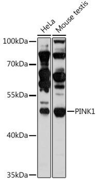 Anti-PINK1 Antibody (CAB11435)