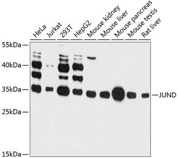 Anti-JUND Antibody (CAB11955)