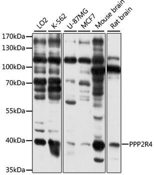 Anti-PPP2R4 Antibody (CAB11999)