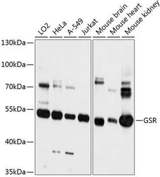 Anti-GSR Antibody (CAB12070)
