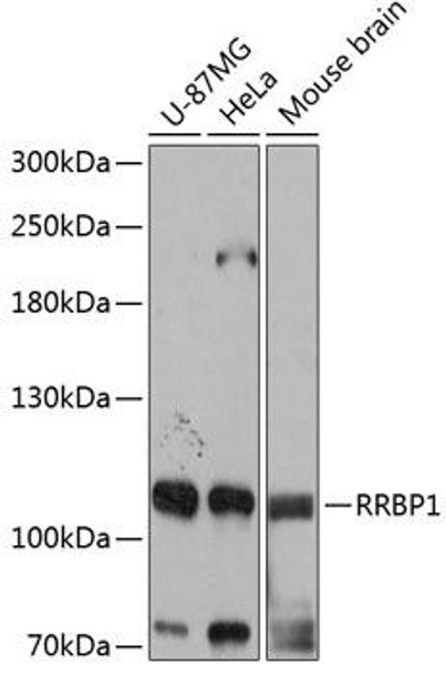 Anti-RRBP1 Antibody (CAB12239)