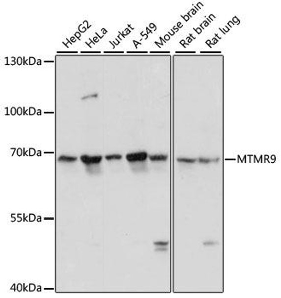 Anti-MTMR9 Antibody (CAB13124)
