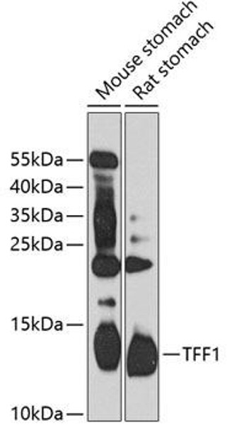 Anti-TFF1 Antibody (CAB13358)