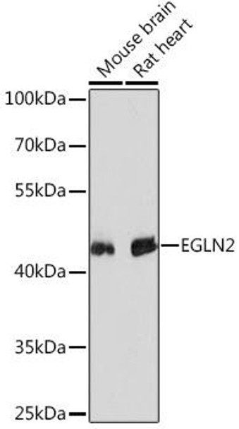Anti-EGLN2 Antibody (CAB13447)