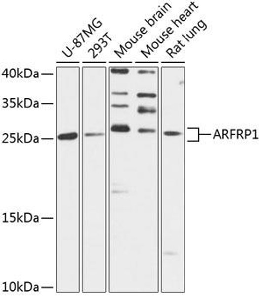 Anti-ARFRP1 Antibody (CAB14311)