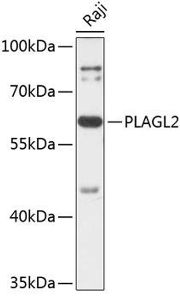 Anti-PLAGL2 Antibody (CAB14318)